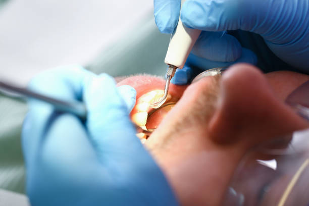 Best Emergency Dental Care for Abscessed Tooth in Park View, IA